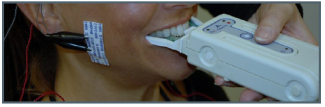 Interferenze dentali in paziente con disordine cranio-mandibolare fig 2