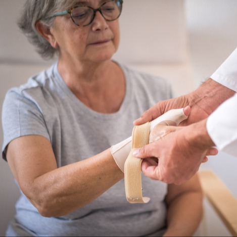 Illustrazione grafica per Rizoartrosi (o artrosi trapezio-metacarpale)