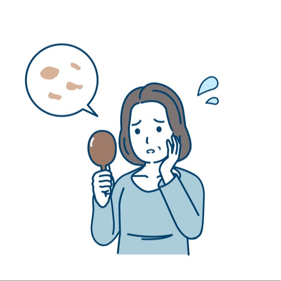 Illustrazione grafica per Cheratosi