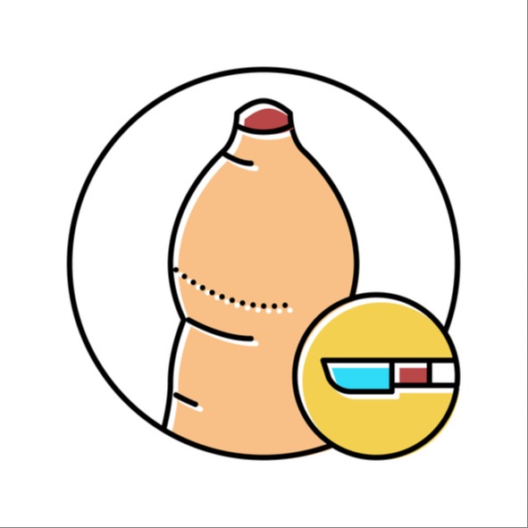 Illustrazione grafica per Fimosi