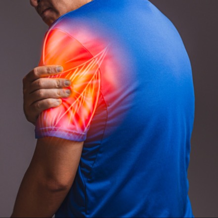 Illustrazione grafica per Dermatomiosite