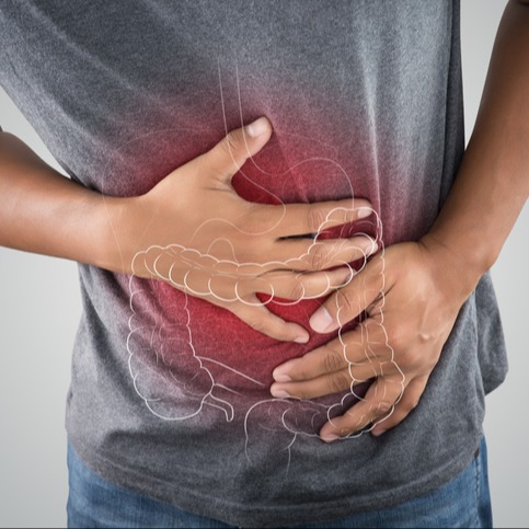 Infiammazione intestinale