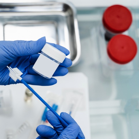 Tumore del collo dell'utero