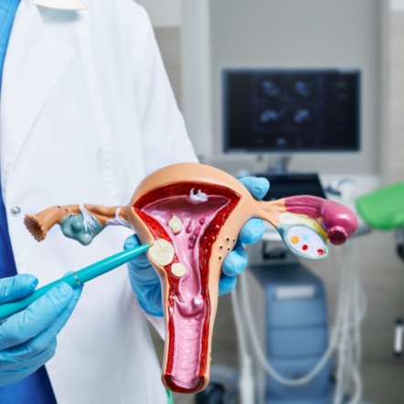Tumore dell'endometrio