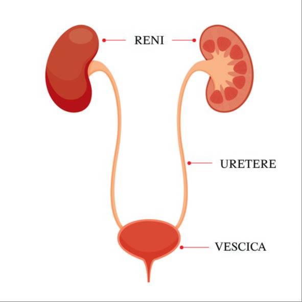 Ureterocele