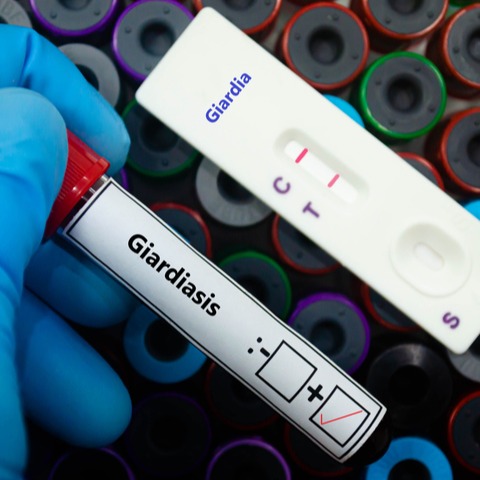 Giardiasi