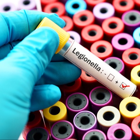 Legionellosi