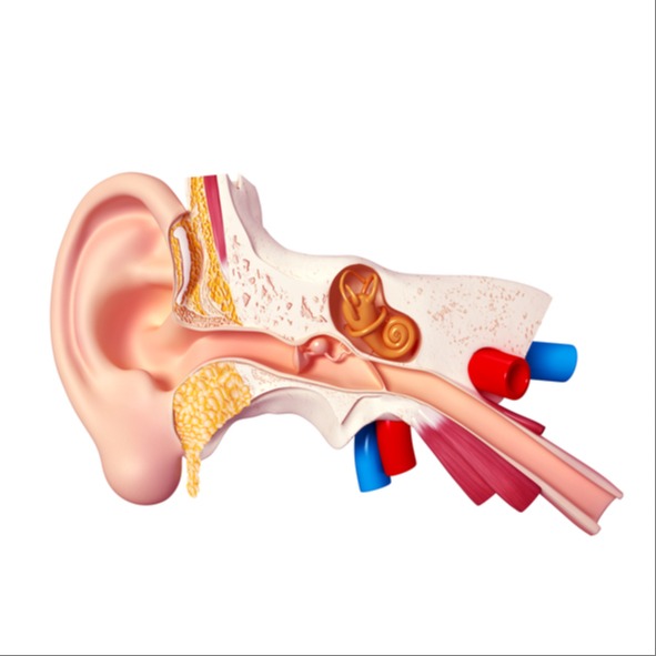 Sindrome di Ménière